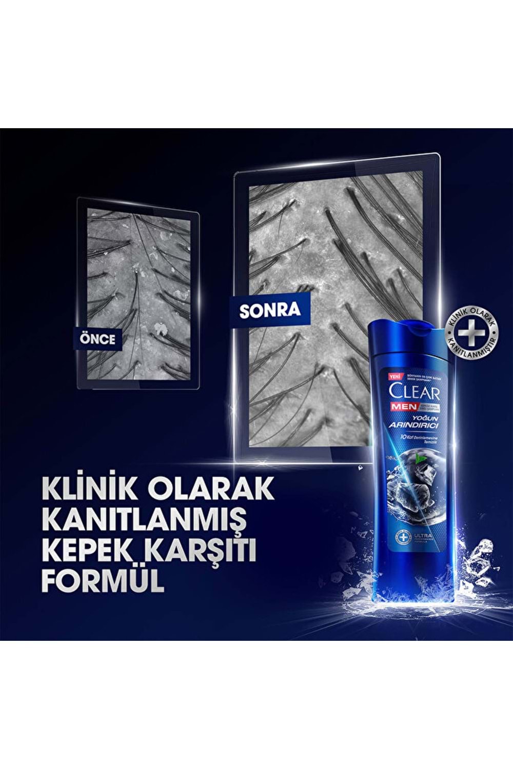 Clear Men Şampuan Yoğun Arındırıcı Kömür Kepeğe Karşı Etkili 350 ml